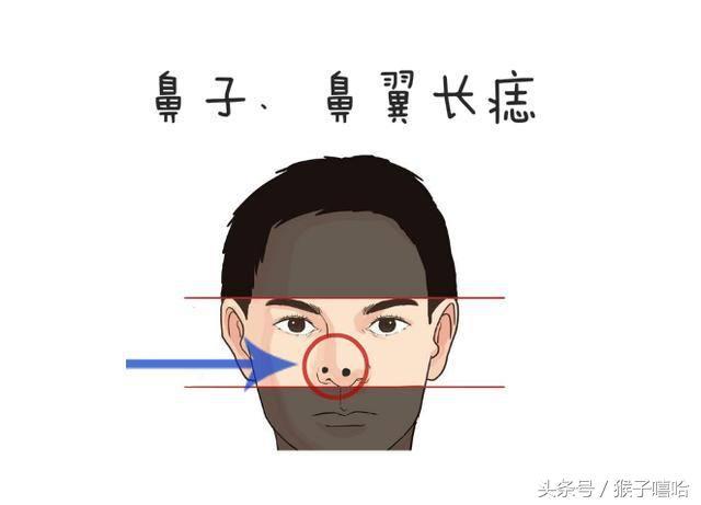 痣长在什么地方最好运势